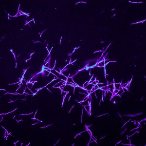 (Martin Kaltenpoth, Universität Mainz)