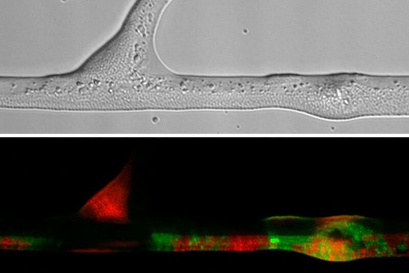 Bild oben: Durchlichtmikroskopische Aufnahme von Bakterien (Pseudomonas putida) entlang einer Hyphe (Pythium ultimum). Bild unten: Fluoreszenzmikroskopische Aufnahme der durch Gentransfer entstandenen Bakterien (in Grün) entlang der im oberen Bild dargestellten Hyphe. (Berthold et al. 2016 in Scientific Reports)