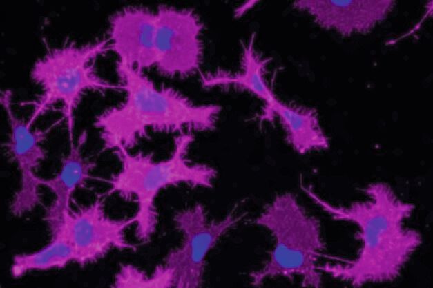 Mit Lentivirus infizierte Mikrogliazellen. Rouven Schulz, Doktorand in der Siegert-Forschungsgruppe, brachte mithilfe eines Lentivirus Mikrogliazellen – Teil des Immunsystems im Gehirn – dazu, einen bestimmten G-Protein-gekoppelten Rezeptor zu produzieren. Mit einer Immunfluoreszenzfärbung (magenta) machte er die Rezeptoren auf der Zelloberfläche sichtbar. Außerdem färbte er die Zellkerne mit einem anderen Farbstoff blau ein.