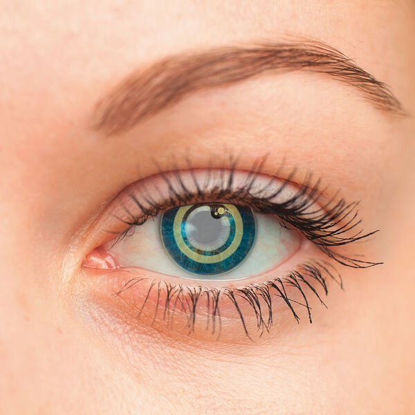 Nach einer minimal-invasiven Implantation überwacht der Mikrosensor kontinuierlich den Augeninnendruck bei Grünem-Star-Erkrankungen. (Cicor)