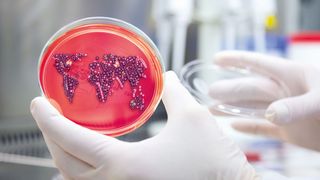 Zeitaufwändig: Bisher müssen Bakterien auf Nährboden gezüchtet werden, um Resistenzen zu erkennen. Spezielle Tests und Gendaten sollen schneller Gewissheit schaffen.  (Curetis)