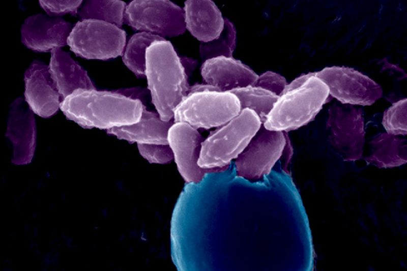 Resistente Pilzsporen Dass Antibiotikaresistenzen ein Problem sind, ist hinlänglich bekannt. Das gleiche Phänomen tritt aber auch bei Medikamenten gegen pathogene Pilze auf. Ein internationales Forschungsteam hat den Mechanismus entschlüsselt, mit dem der Pilz Cryptococcus neoformans resistent gegen pilzspezifische Arzneimittel ist. Es handelt sich um einen hefeähnlichen Pilz, der Menschen infizieren kann.  Die rasterelektronische Aufnahme zeigt infektiöse Hefesporen (lila) auf der Oberfläche von Basidien (blau), den sexuellen Vermehrungsorganen des Pilzes.  Bild: Chaoyang Xue, Kasey Carroll, and Joseph Heitman (Duke University Department of Molecular Genetics and Microbiology); and Valerie Knowlton (North Carolina State University, Center for Electron Microscopy)   Hier gehts zur Originalmeldung Wissenschaftsbild des Tages vom 9.8.2022  (Chaoyang Xue, Kasey Carroll, and Joseph Heitman and Valerie Knowlton)