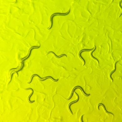 Humans and the tiny worms known as C. elegans nematodes share many of the same genes, including those affected by the rare childhood disease AHC.  (Source: Diana Wall/Brown University)