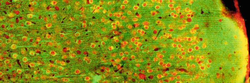 Epifluoreszenzbild der hinteren Inselrinde der Maus, wo Forscher den „thermischen Kortex“ verorten: Die Neuronen exprimieren ein kalziumempfindliches Protein grün und einen allgemeinen neuronalen Marker rot. Epifluoreszenzbild der hinteren Inselrinde der Maus, wo Forscher den „thermischen Kortex“ verorten: Die Neuronen exprimieren ein kalziumempfindliches Protein grün und einen allgemeinen neuronalen Marker rot.