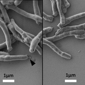 (Andreas Wiesner/DZIF)