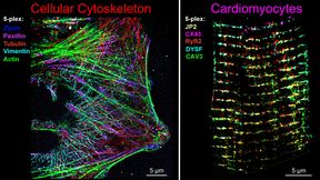 Abb. 1: Fünffach-multiplexierte DNA-PAINT-Super-Resolution-Aufnahme mit automatisiertem mikrofluidischem Lösungswechsel. (Bild: III. Physikalisches Institut Biophysik, Universität Göttingen; Adaptiert nach Basak et al., ACS Nano 20 (2026), unter der Lizenz CC BY 4.0)