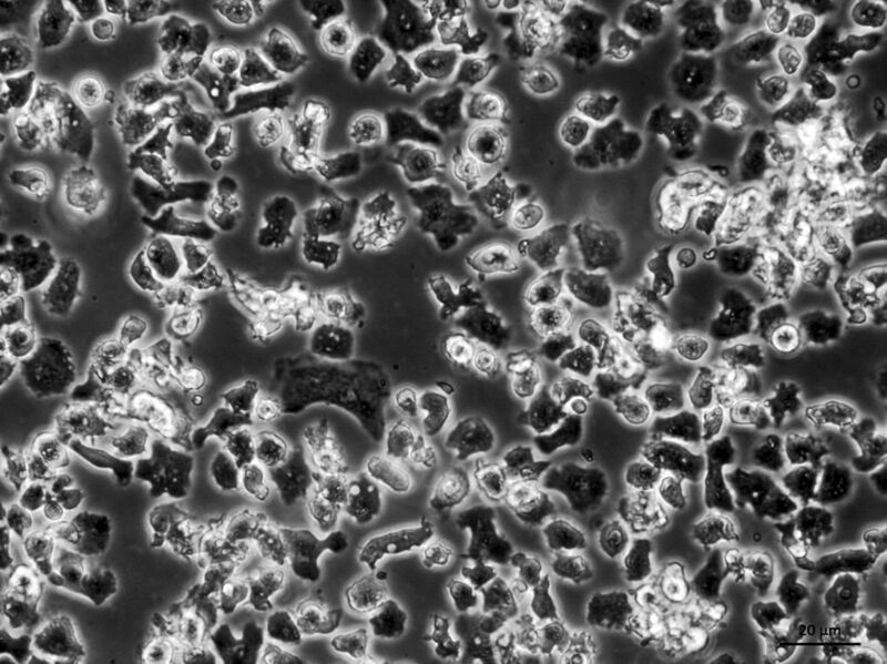 Mikroskopische Aufnahme einer Amöbenkultur (Pierre Stallforth/HKI)