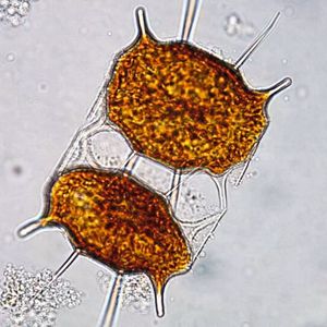 Kieselalgen sind auf unserem Planeten äußerst zahlreich und tragen wesentlich zur Produktion von Sauerstoff bei. Jeden vierten Atemzug verdanken wir ihnen. Und sie haben noch weitere Eigenschaften, die Forscher verblüffen: Kieselalgen leben in Schalen aus Glas, die wie ein Fenster Sonnenlicht hindurchlassen und mit Nanoporen ausgestattet sind. (Bild:  Johannes W. Goessling / NASCADIA-Projekt)