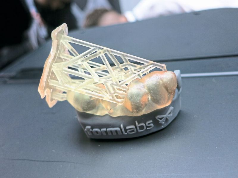 Und so sieht die Zahnschiene von Nahem aus. (Bild: Schäfer / Devicemed)