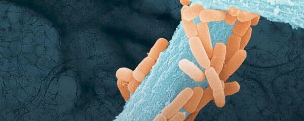 Das Wachstum von 𝘓𝘪𝘨𝘪𝘭𝘢𝘤𝘵𝘰𝘣𝘢𝘤𝘪𝘭𝘭𝘶𝘴 𝘮𝘶𝘳𝘪𝘯𝘶𝘴 (orange), Bestandteil des Lungenmikrobioms der Maus, entlang der Hyphen des lungenpathogenen Pilzes 𝘈𝘴𝘱𝘦𝘳𝘨𝘪𝘭𝘭𝘶𝘴 𝘧𝘶𝘮𝘪𝘨𝘢𝘵𝘶𝘴 (blau), mit Lungengewebe im Hintergrund. (Bild:  Liubov Nikitashina (Leibniz-HKI) und Sandor Nietzsche (EMZ-UKJ))