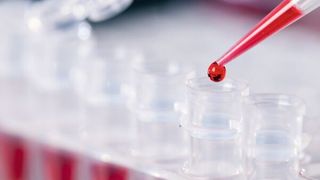 Abb. 1: Ob PCR, Verdünnungsreihe oder ELISA – Pipettieren gehört zu den wesentlichen Routine-Aufgaben im Labor. Präzision ist hier oberstes Gebot. (© science photo – stock.adobe.com)