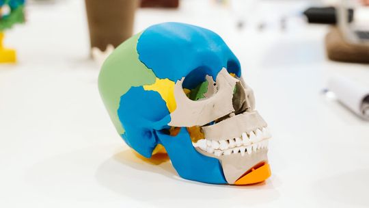 Modell für die Schädelchirurgie aus dem 3D-Lab des Radboud UMC Nimwegen(Bild:  Merel Tuk/Deltagoud)