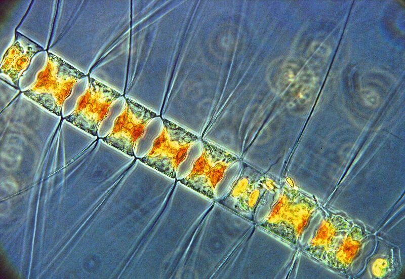 Kieselalgen, auch Diatomeen genannt, sind eine wichtige Planktongruppe im Ozean. Im Bild: Chaetoceros diadema