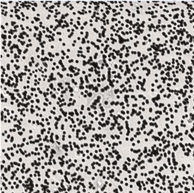 Bild 1: REM-Aufnahme der Ventikon-Membran: geordnete Struktur, die sich partiell in einem Bereich konzentriert. (Bild: Konzelmann)