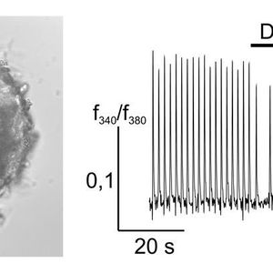 (© RUB, Jovancevic/Hatt)