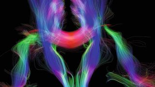 Neuronale Bahnen des Gehirns im MRT (Bild: MPI CBS)