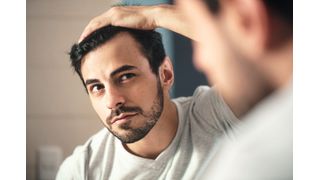 Ein Forschungsteam aus Köln und Helsinki hat einen Mechanismus entdeckt, der Haarausfall verhindert. (Bild: ©diego cervo - stock.adobe.com)