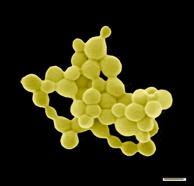 Eine weitere Aufnahme der Goldkörnchen (Technische Universität München)