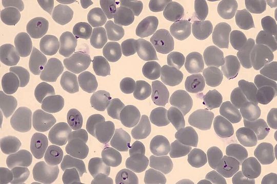 Mit Plasmodium falciparum infizierte rote Blutkörperchen.(Bild:  Armin Passecker)