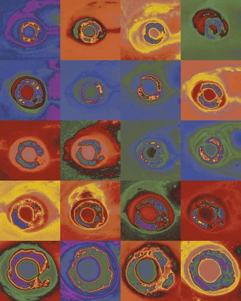 Augenweide für Biologen Was wie ein modernes Gemälde aussieht, ist ein Bild der Entwicklung eines Zebrafisch-Auges. Im Zeitraum von 3 Tagen (oben) bis 15 Tagen (unten) wächst das Auge erheblich. Dieses Wachstum geht mit Veränderungen im Gehirnnetzwerk einher, die es dem Zebrafisch ermöglichen, seinen Blick zu stabilisieren.  Eine Studie der NYU Grossman School of Medicine zeigt, dass sich der vestibulo-okuläre Reflex (VOR) ohne sensorisches Feedback entwickelt. Dieser Reflex stabilisiert das Sehfeld, indem die Augen bei einer Neigung gegenbewegend rotieren. Interessanterweise erfolgt die langsamste Entwicklung an der neuromuskulären Verbindung und nicht im Gehirn. Diese Entdeckung könnte neue Ansätze für die Behandlung von Balance- und Augenbewegungsstörungen bieten. Hier gehts zur Originalmeldung Wissenschaftsbild des Tages vom 09.01.2025  (Bild: NYU Grossman School of Medicine)