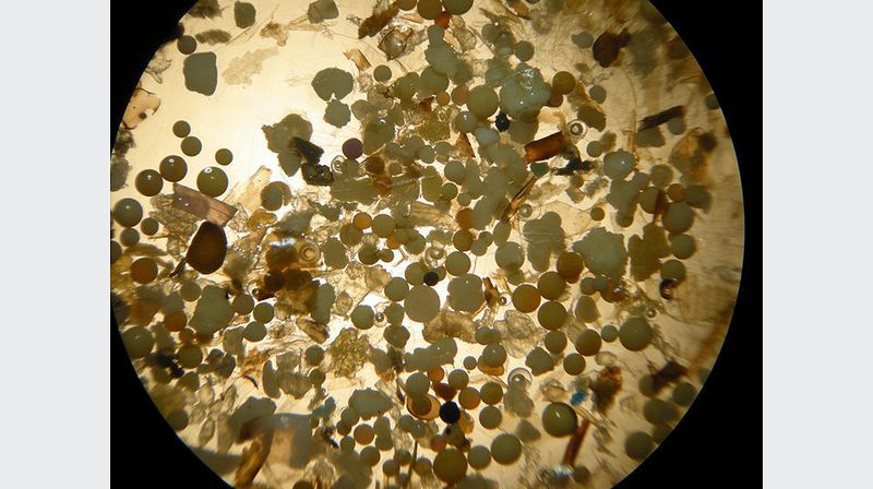 Probe aus dem Rhein bei Duisburg mit über 65% opaken Mikroplastikkügelchen in 15-facher Vergrösserung; der Durchmesser der Kügelchen beträgt 400–900 Mikrometer. (Foto: Universität Basel, Thomas Mani)