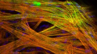 Forschende des Max-Delbrück-Centrum für Molekulare Medizin in der Helmholtz-Gemeinschaft (MDC) haben eine bisher unbekannte Ursache für die Herzhypertrophie gefunden. Sie gilt als die häufigste Ursache für den plötzlichen Herztod.  (Bild: Mariana Guedes Simoes, AG Panakova, MDC)