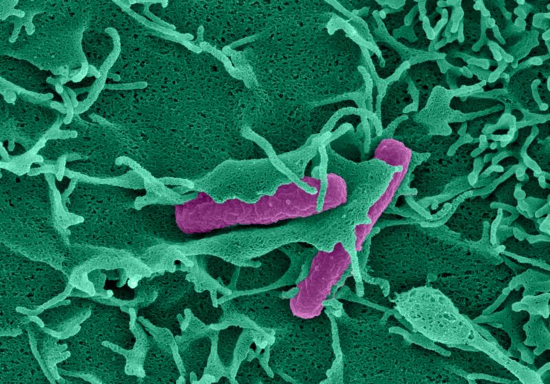 Schutzmechanismus von Darmzellen  Das Immunsystem muss stets in Alarmbereitschaft sein, um gefährliche Mikroben aufzuspüren und zu entfernen. Forscher der schwedischen Universität Umeå haben nun einen erstaunlichen Mechanismus entdeckt, mit dem unser Köper Eindringlinge aufspürt: Darmzellen erkennen schädliche Bakterien durch die mechanische Kraft, die während der bakteriellen Invasion auf ihre Zelloberfläche ausgeübt wird. Entscheidend für diese Fähigkeit ist ein Protein namens Piezo1.   Die farbige elektronenmikroskopische Aufnahme zeigt eine entstehende Plasmamembran-Falte, die ein Bakterium umschließt, das in eine Darmepithelzelle eindringt.    Hier gehts zur Originalmeldung Wissenschaftsbild des Tages vom 23.8.2022 (Felipe Ramón Cervantes-Rivera; Färbung/Rendering: Atin Sharma. MIMS, Universität Umeå)