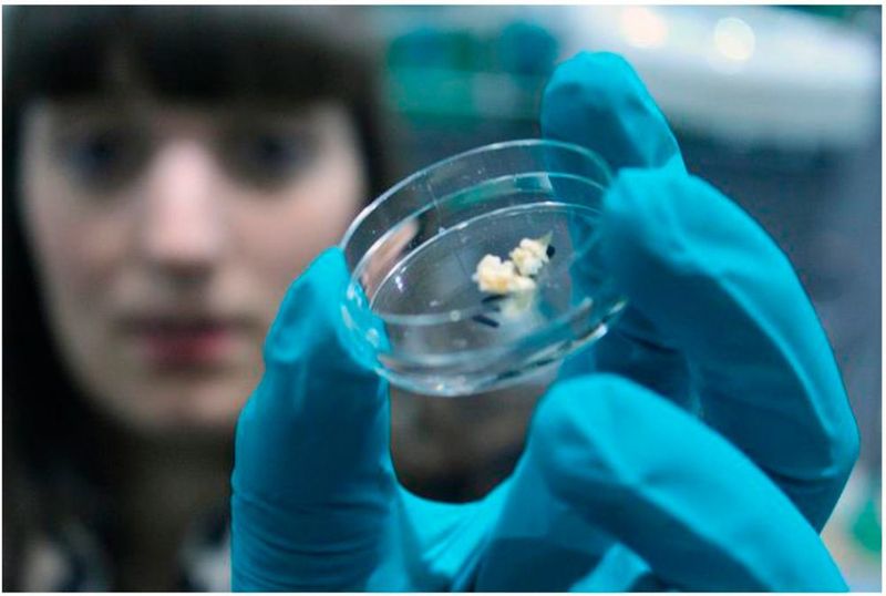 McGill research team studies how calcium compounds accumulate in the arteries (McGill University)