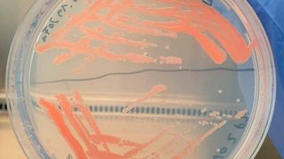 Jetzt wird aus dem Klimaschädling CO2 einfach Kunststoff gemacht! Denn Mikroorganismen, hier im Bild, bei der Umwandlungsarbeit, stellen aus den Zwischenprodukten Methanol und Ameisensäure Polymer-Bausteine her, wie Forschende am Fraunhofer-IGB zeigen können. (Fraunhofer-IGB)