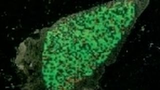 Gesundes Gewebe bei einer histologischen Untersuchung. (Archiv: Vogel Business Media)