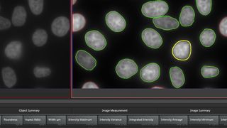 Leica Application Suite Advanced Fluorescence (LAS AF) 4.0 ist die Softwareplattform für anspruchsvolle biomedizinische Forschung mit Weitfeld- und Konfokalmikroskopie. Die Abbildung zeigt das 2D-Analyse Modul bei der automatischen Zellkernzählung. (Bild: Leica Microsystems)