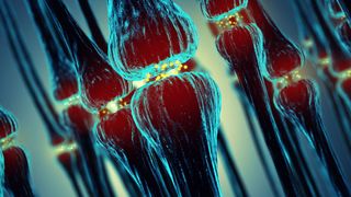 Multiple Sklerose (MS) ist eine chronisch-entzündliche Autoimmunerkrankung des zentralen Nervensystems, bei der die Isolierschichten der Nervenfasern zerstört werden. (© nobeastsofierce - Fotolia)