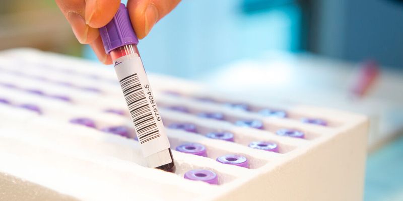 Viele Studienergebnissen lassen sich nicht replizieren – also nicht originalgetreu bestätigen. Das kann für die Wissenschaft zum Glaubwürdigkeitsproblem werden.(Bild: ©  benjaminnolte - stock.adobe.com)