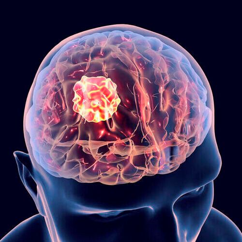 The drug is a cell cycle inhibitor, meaning it blocks the cell division cycle and inhibits tumor growth. The drug is a cell cycle inhibitor, meaning it blocks the cell division cycle and inhibits tumor growth.