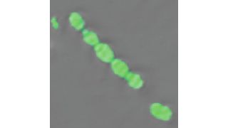 Unscheinbar, aber gefährlich: Das Bakterium Streptococcus pneumoniae kann und Lungen- und Hirnhautentzündung auslösen. (© MPI für Kolloid- und Grenzflächenforschung)