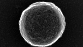 A Caltech-led team has developed a way of making bubble bots with simple protein shells that can be modified by enzymes or magnetic nanoparticles for efficient drug delivery. One version the researchers has made is "smart" enough to direct itself to direct itself to a tumor target. (Source: Gao Lab/ Caltech)