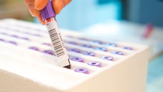 Viele Studienergebnissen lassen sich nicht replizieren – also nicht originalgetreu bestätigen. Das kann für die Wissenschaft zum Glaubwürdigkeitsproblem werden. (Bild: © benjaminnolte - stock.adobe.com)