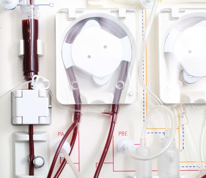 Dialysegeräte: In medizinischen Apparaturen für die Blutwäsche sorgen integrierte Ultraschallsensoren für gleichmäßigen und luftblasenfreien Flüssigkeitstransport. (Bild: Sonotec)