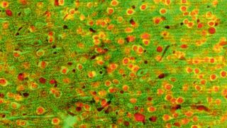 Epifluoreszenzbild der hinteren Inselrinde der Maus, wo Forscher den „thermischen Kortex“ verorten: Die Neuronen exprimieren ein kalziumempfindliches Protein grün und einen allgemeinen neuronalen Marker rot. (Bild: Mikkel Vestergaard, AG Poulet, Max Delbrück Center)