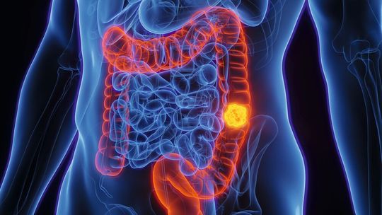 (Bild:  © Sebastian Kaulitzki - stock.adobe.com)