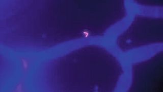 Lebendige Bakterien leuchten im Fettgewebe (Bild: Universität Leipzig, Prof. Peter Kovacs)