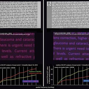 (Schaeffel/Forschungsinstitut für Augenheilkunde, Universitätsklinikum Tübingen)