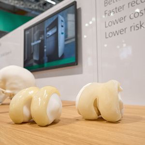 Auch in puncto individualisierte Implantate kann der Kunststoff-3D-Druck seine Vorzüge ausspielen. Das sind Knieeimplantate aus medizinischem TPU. Der Produktname heißt „iKnee“. So ein Implantat kann dann minimalinvasiv ins kaputte Knie eingeführt werden.(Bild:  Arburg)