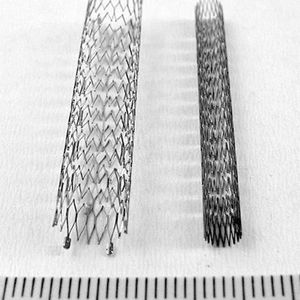 Die Formgedächtnislegierung Nitinol wird bereits sehr erfolgreich in der Medizintechnik für sogenannte Stents – medizinische Gefäßstützen – eingesetzt.