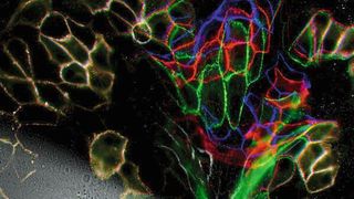 Forscher haben die molekulare Kraftübertragung in Desmosomen, den Verknüpfungspunkten von Hautzellen bestimmt: Vor (blau), während (grün) und nach (rot) der Anwendung mechanischen Stresses. (Grashoff und Dunn Gruppen)