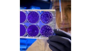 Due to antibiotic resistance, there’s a huge public health need to develop new antibiotics quickly. (Source: free licensed)