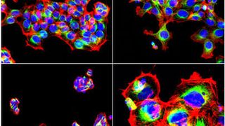 Automatisierte Mikroskopie dokumentiert die Veränderungen der Zellen nach Behandlung mit einer Testsubstanz (© M. Boutros/Deutsches Krebsforschungszentrum)