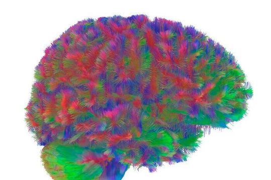 A representative MRI tractography image of the first era of the human brain. This image is representative of the general pattern seen across the brains in the study during the first era of neural wiring, between the ages of zero and nine. (Source:  Dr Alexa Mousley/ University of Cambridge)