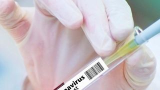 Österreichische Forscher haben eine High-Speed-Technologie im Kampf gegen Covid-19 entwickelt. (gemeinfrei)