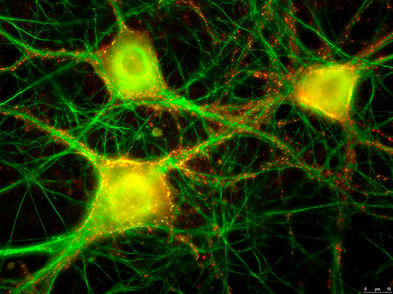 Vergrösserung der neuronalen Kultur. In grün sind wiederum Strukturen der Neuronen ersichtlich. Die gelben und roten Punkte zeigen die „Angriffspunkte“ des Botulinumtoxins (Rezeptoren), an denen es andockt, um in die Nervenzelle zu gelangen. (© Stephen Jenkinson, Institut für Infektionskrankheiten)
